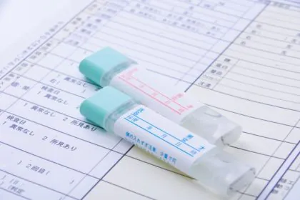 便潜血検査の写真